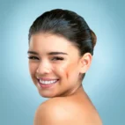 Dermapen Facial 4